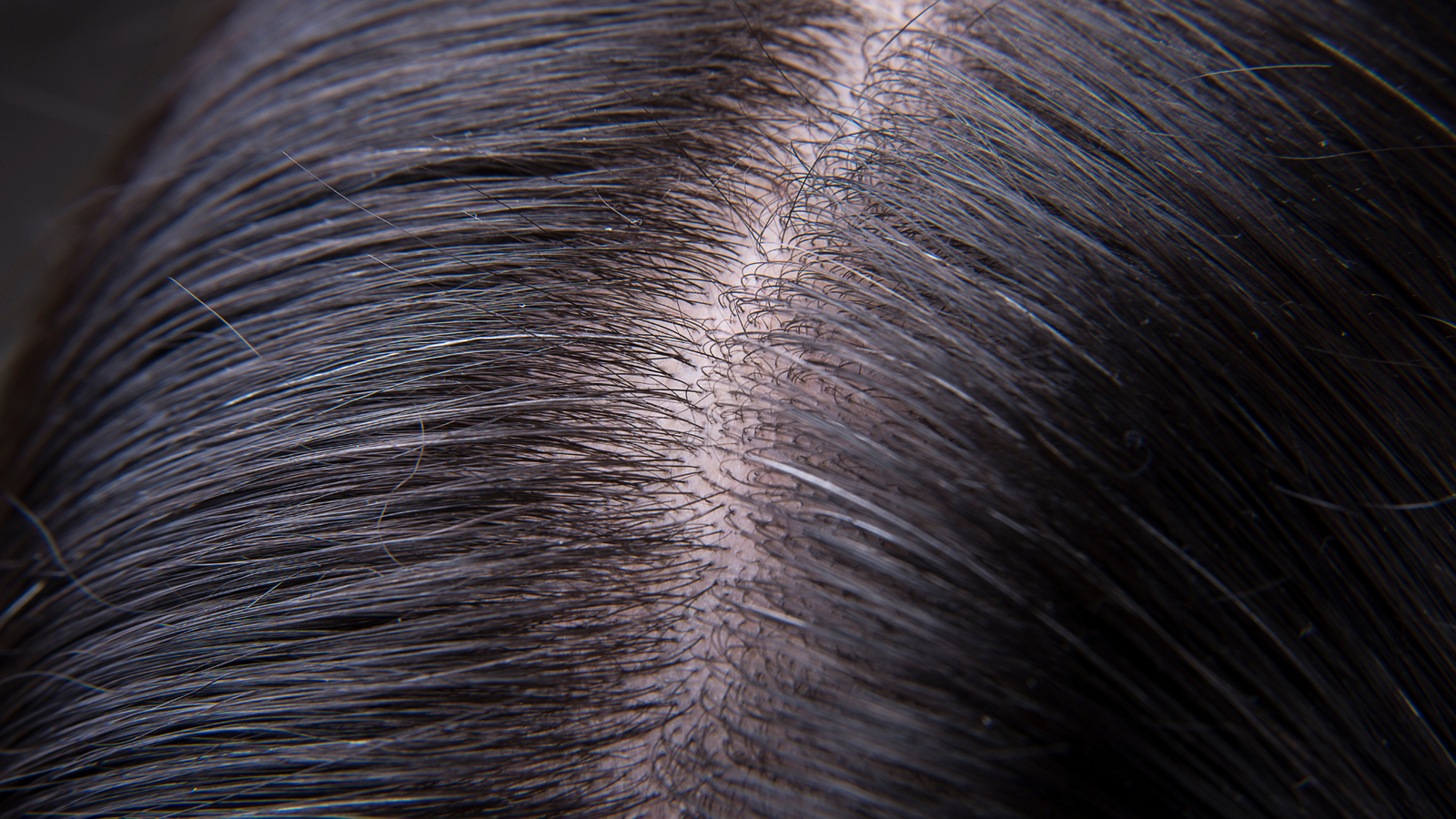 Ciocca di capelli bianchi tra capelli scuri