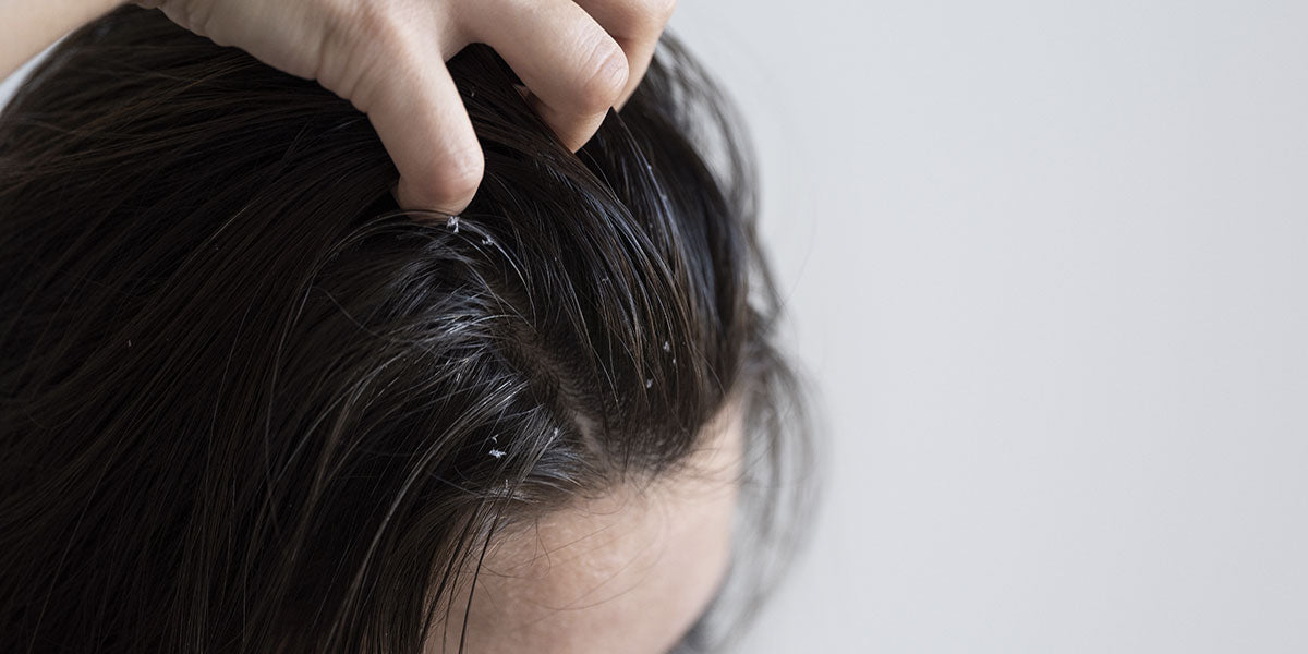 Capelli grassi alla radice che necessitano di uno shampoo seboregolatore