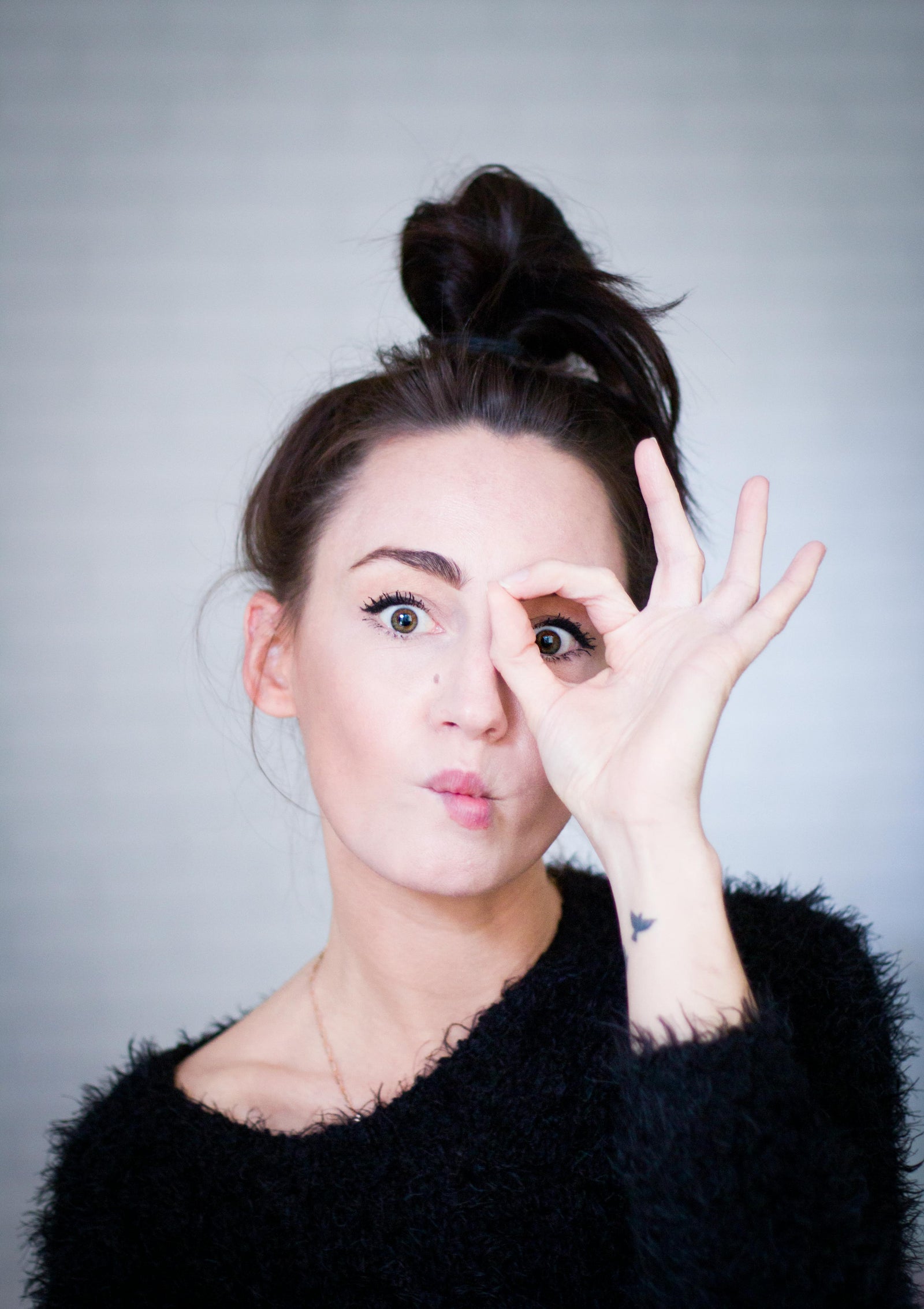 Donna con cuoio capelluto e problema di forfora sui capelli