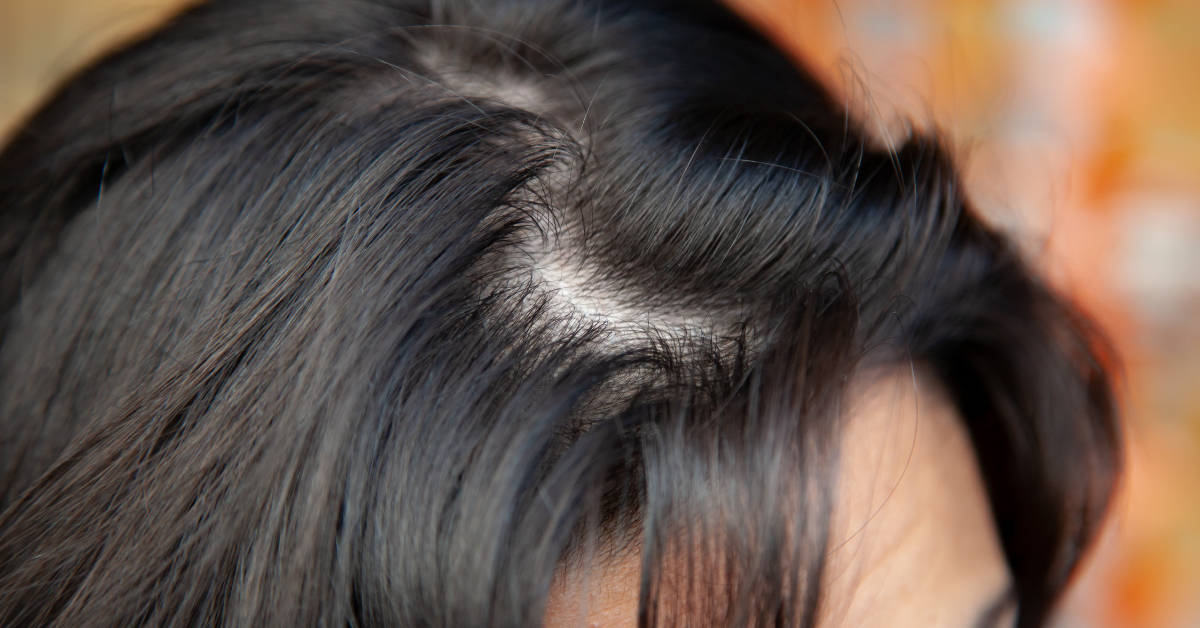 Diversi shampoo professionali per cute grassa, secca e normale